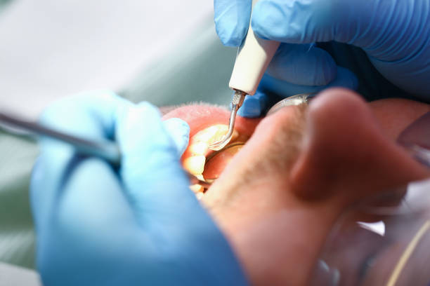 Best Dentist for Tooth Abscess  in Jensen Beach, FL
