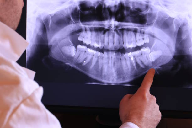 Best Knocked-Out Tooth Emergency  in Jensen Beach, FL