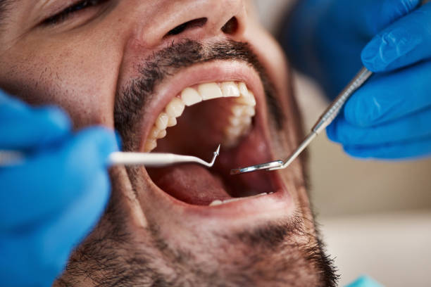 Emergency Dentist Open Today in FL