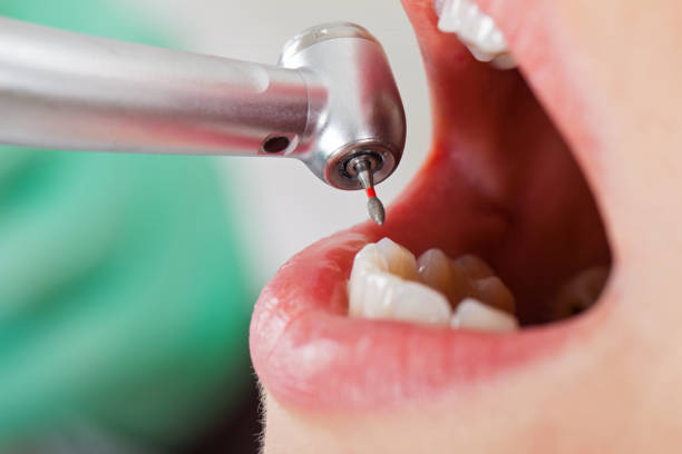 Best Emergency Tooth Extraction  in Jensen Beach, FL